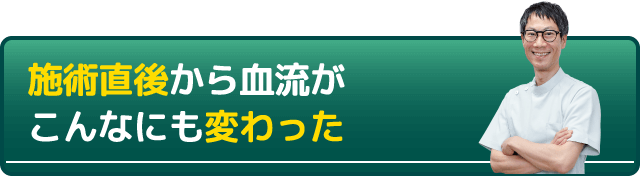施術直後から血流がこんなにも変わった